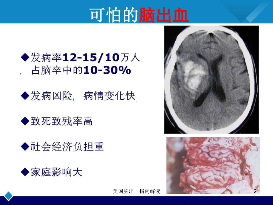 美国脑出血指南解读课件.ppt_第2页