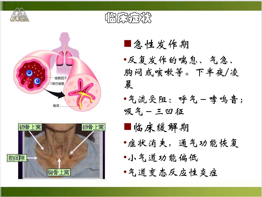 第十九支气管哮喘课件.ppt_第3页