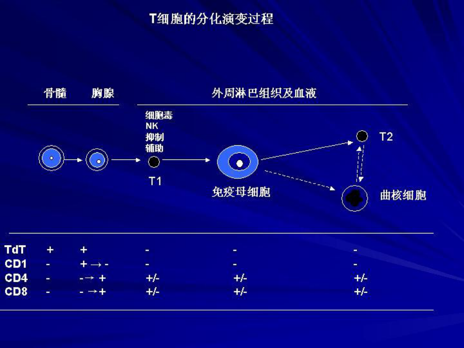 NKT细胞淋巴瘤-课件.ppt_第2页