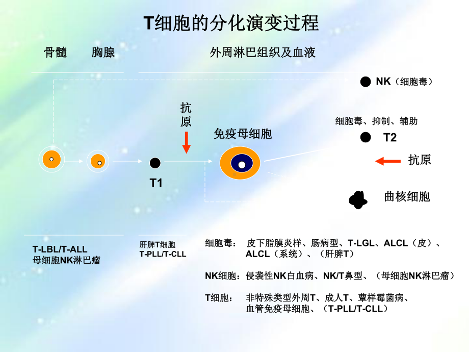 NKT细胞淋巴瘤-课件.ppt_第3页