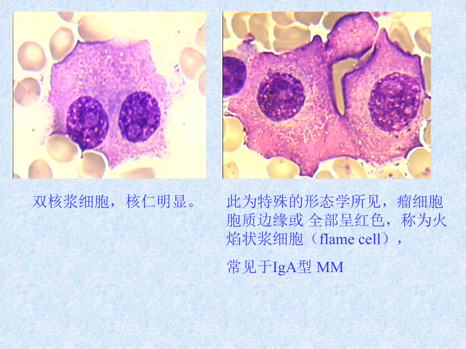 细胞形态学诊断的再认识课件.pptx_第3页