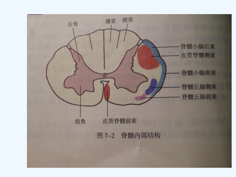 神经病学脊髓病变课件.ppt_第3页