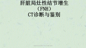 肝脏局灶性结节增生(FNH)CT诊断与鉴别课件.ppt