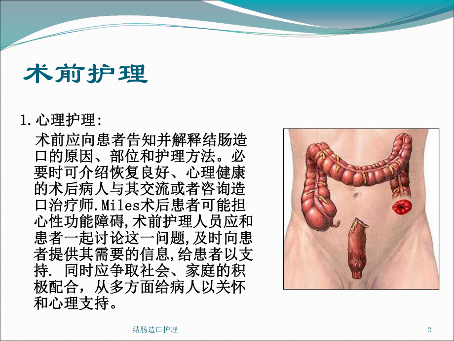 结肠造口护理培训课件.ppt_第2页