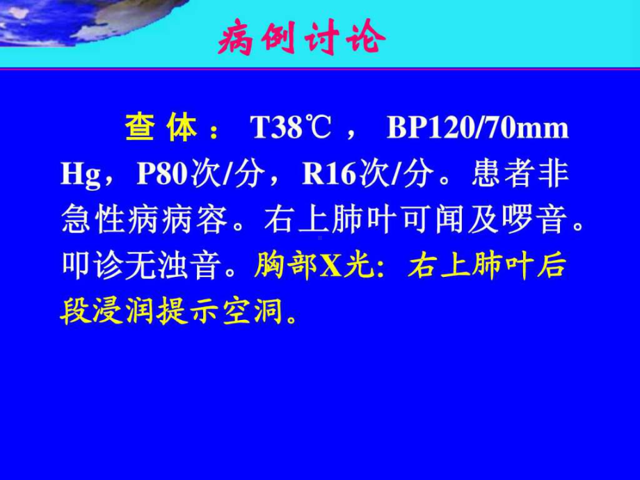 结核分枝杆菌课件.ppt_第3页