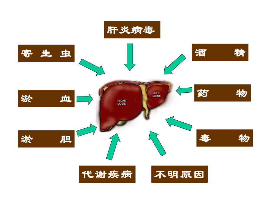 肝硬化讲课课件.pptx_第3页