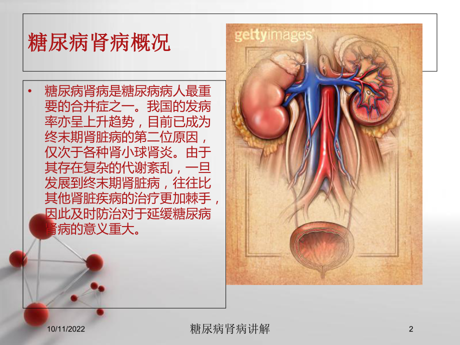 糖尿病肾病讲解培训课件.ppt_第2页