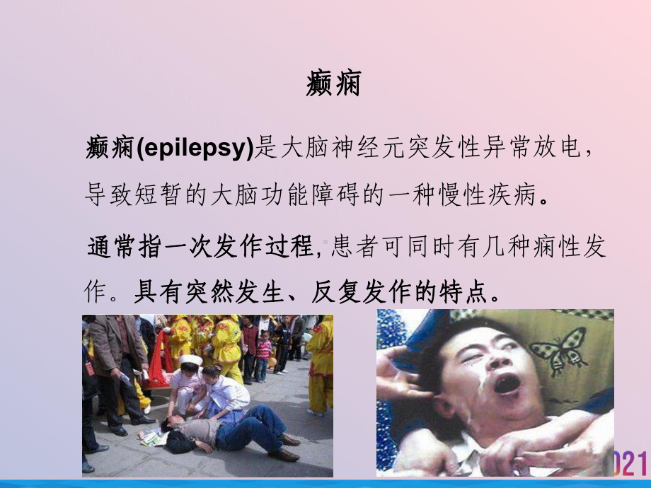 癫痫的发病机制与治疗课件.ppt_第2页