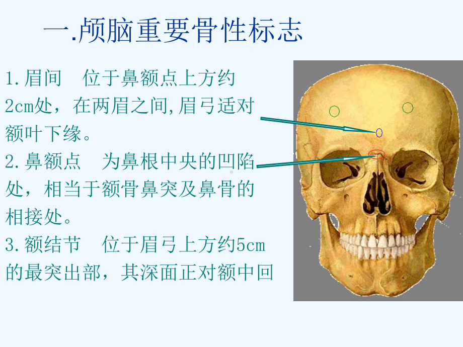 神经外科常见手术切口和入路课件2.ppt_第3页