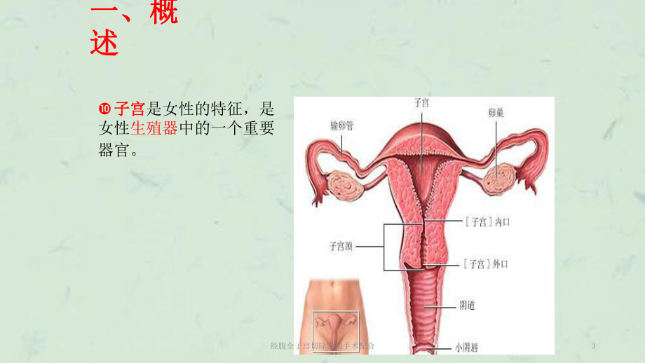 经腹全子宫切除术的手术配合课件.ppt_第3页