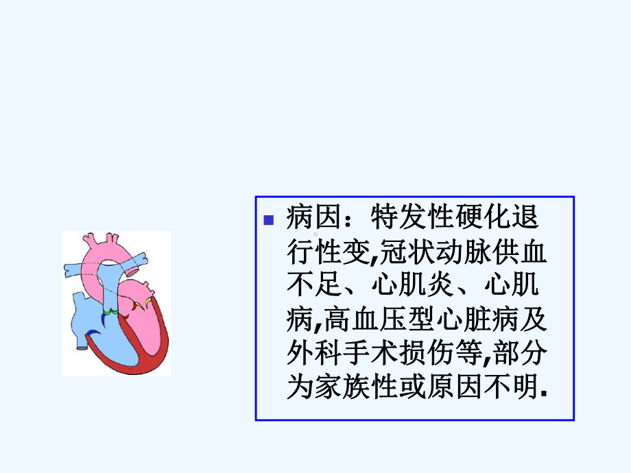 病窦综合征护理查房课件.ppt_第3页