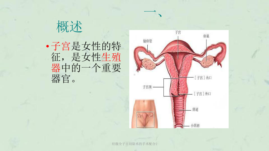 经腹全子宫切除术的手术配合2课件.ppt_第3页