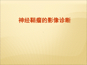 神经鞘瘤的影像诊断(课件).ppt