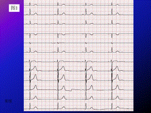 级专科医生培训心电图度考核题课件.pptx