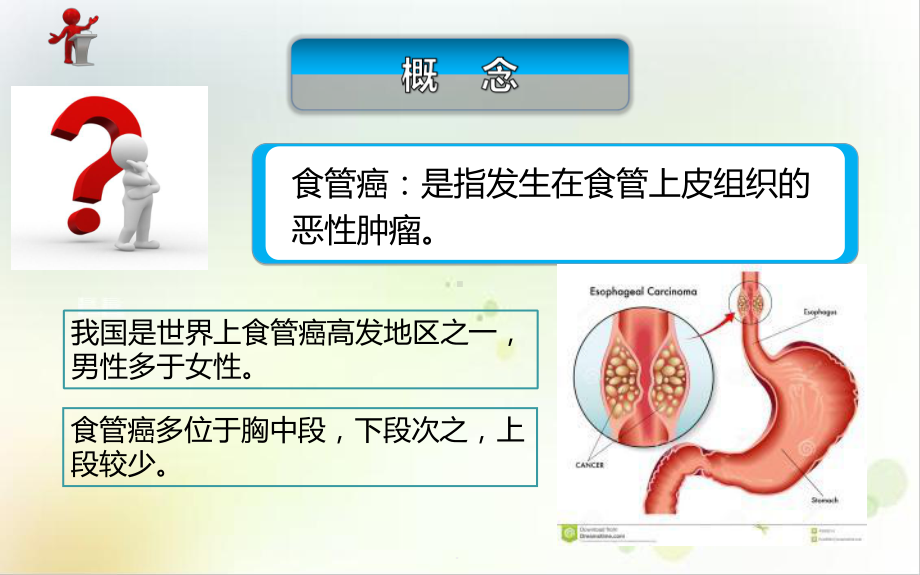 第十三章第四节食管癌病人的护理课件1.ppt_第3页