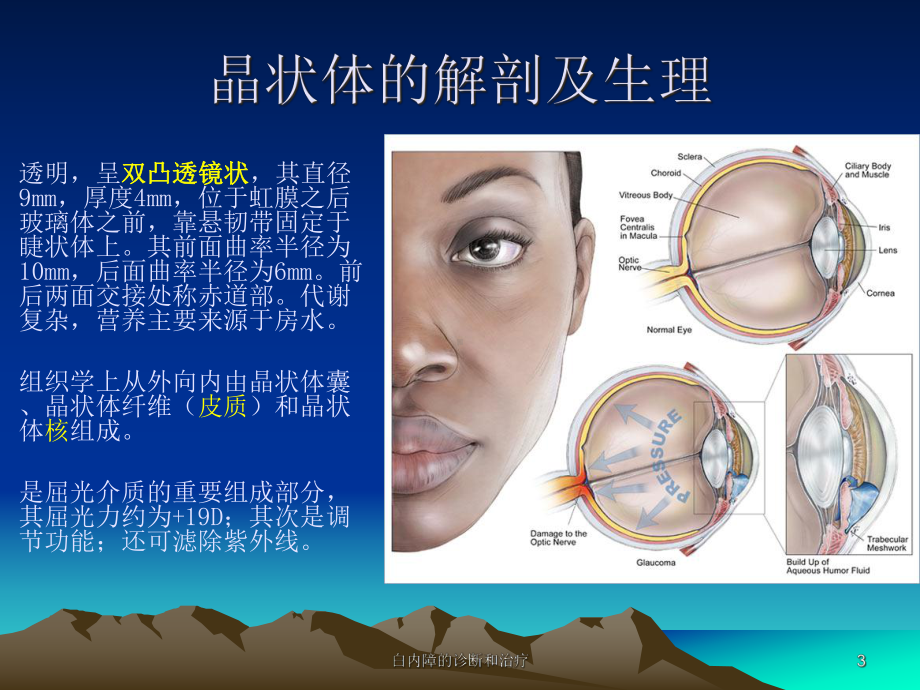 白内障的诊断和治疗培训课件.ppt_第3页