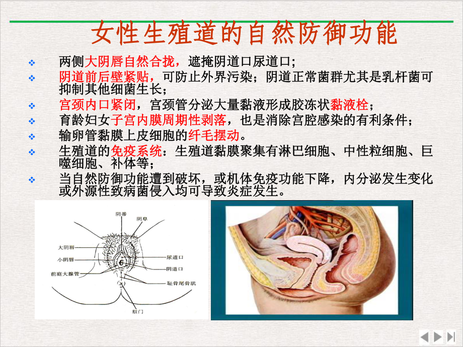 盆腔附件炎新版课件.pptx_第3页