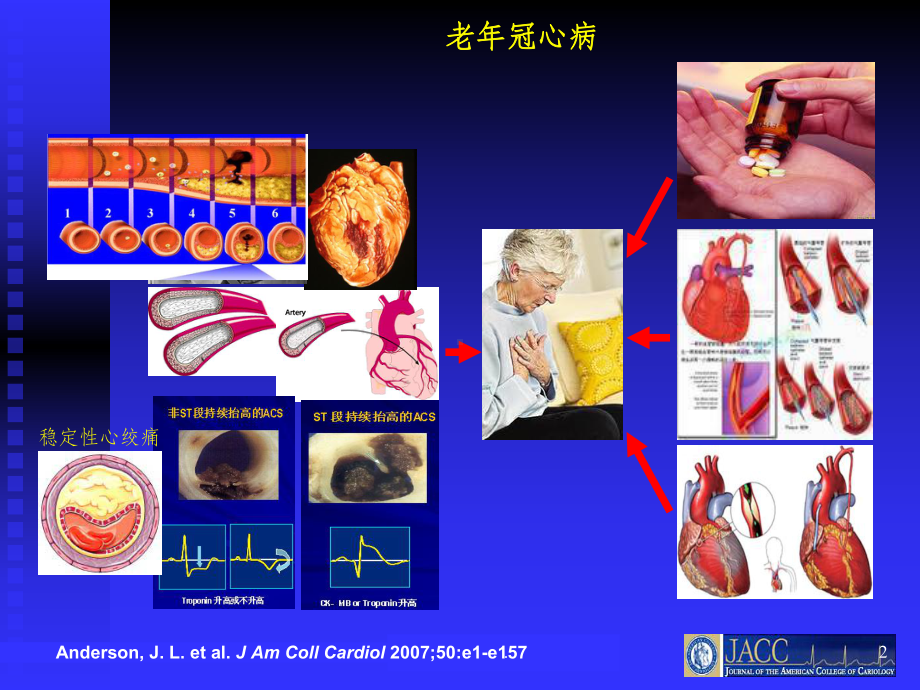 老年冠心病患者心脏康复治疗的基本概念课件-2.ppt_第2页