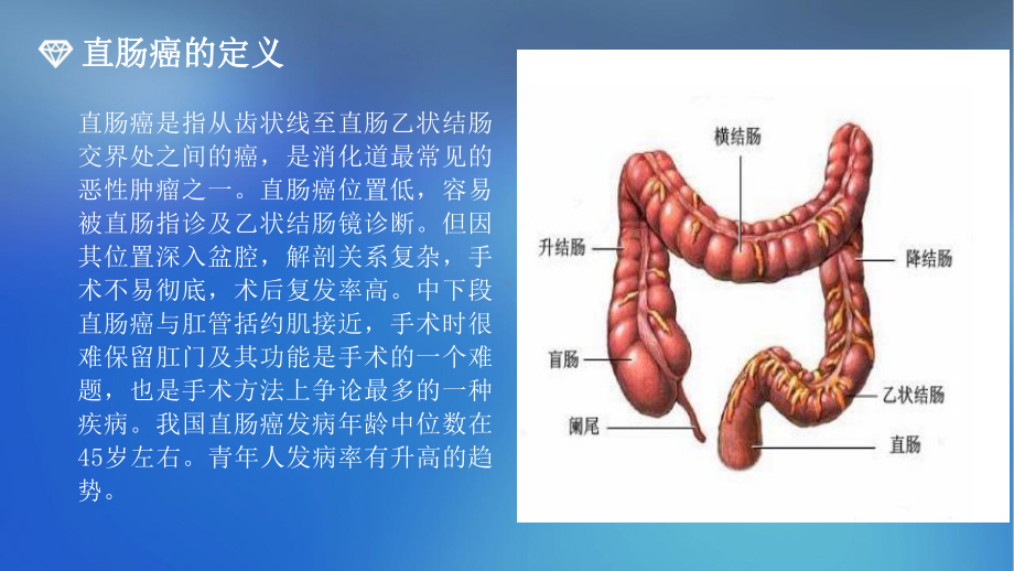 直肠癌优秀课件.pptx_第2页