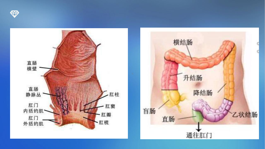 直肠癌优秀课件.pptx_第3页