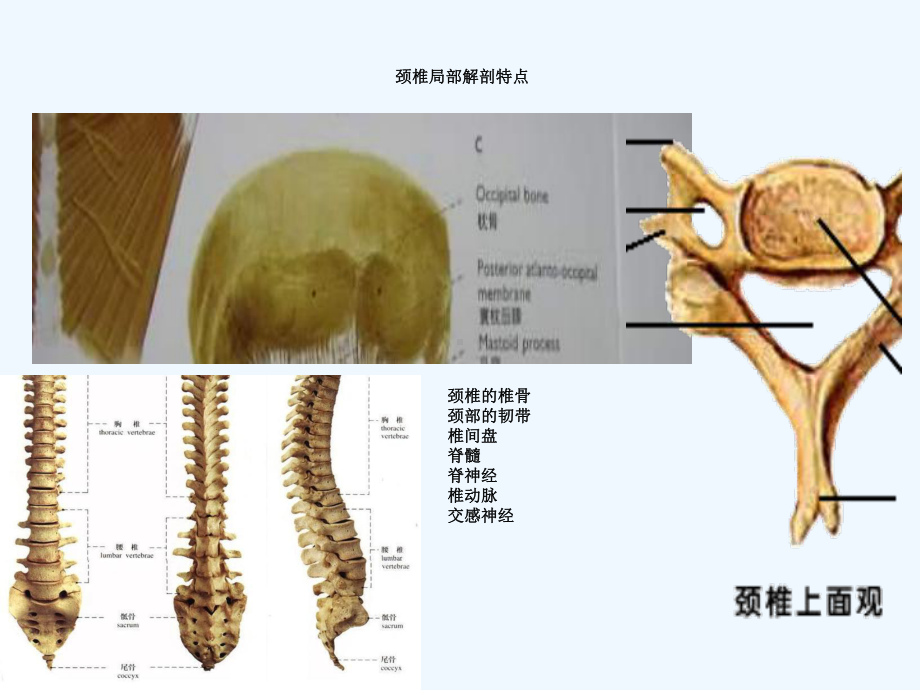 神经根型颈椎病中医特色治疗技术课件.ppt_第3页