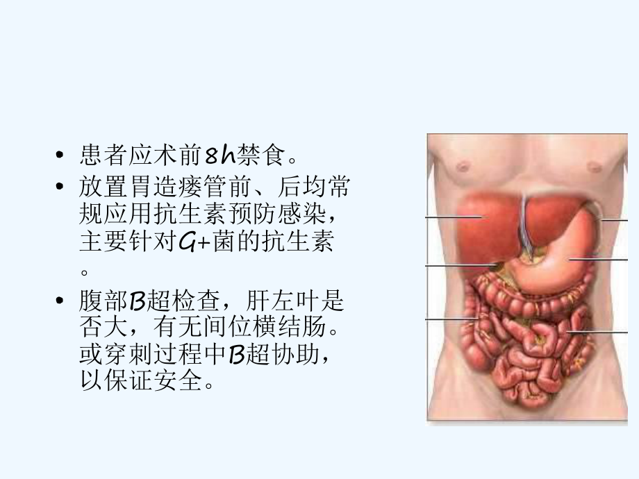 经皮胃镜下胃造瘘术操作与术后护理课件.ppt_第2页