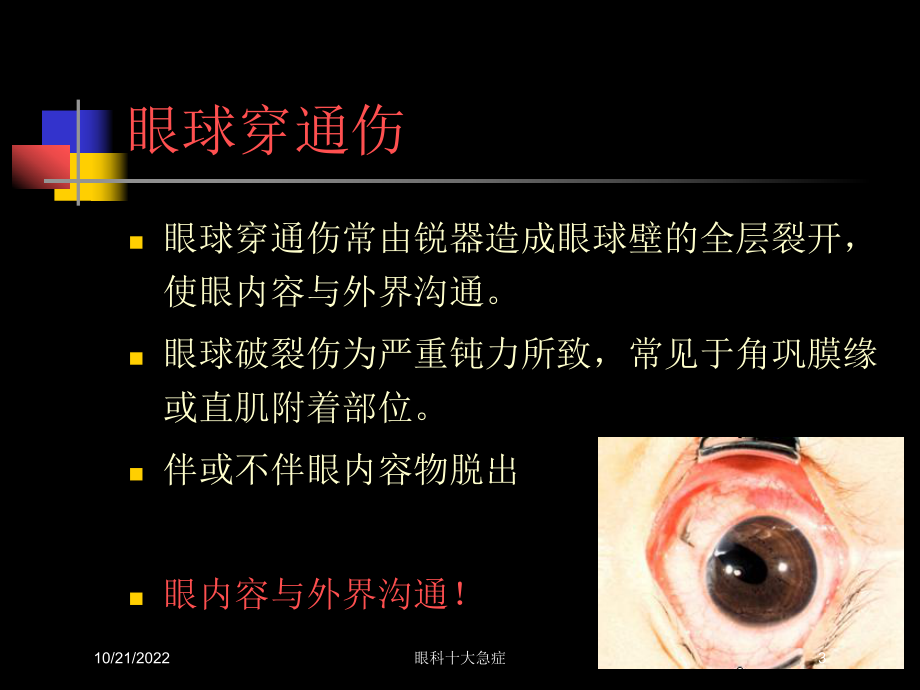 眼科十大急症培训课件.ppt_第3页