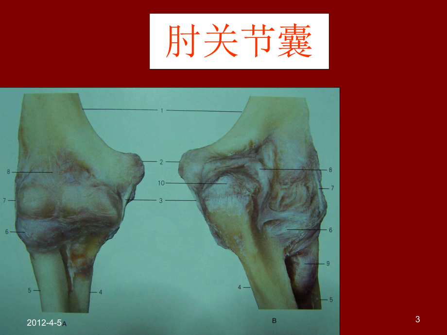 肘部骨折脱位康复课件.ppt_第3页