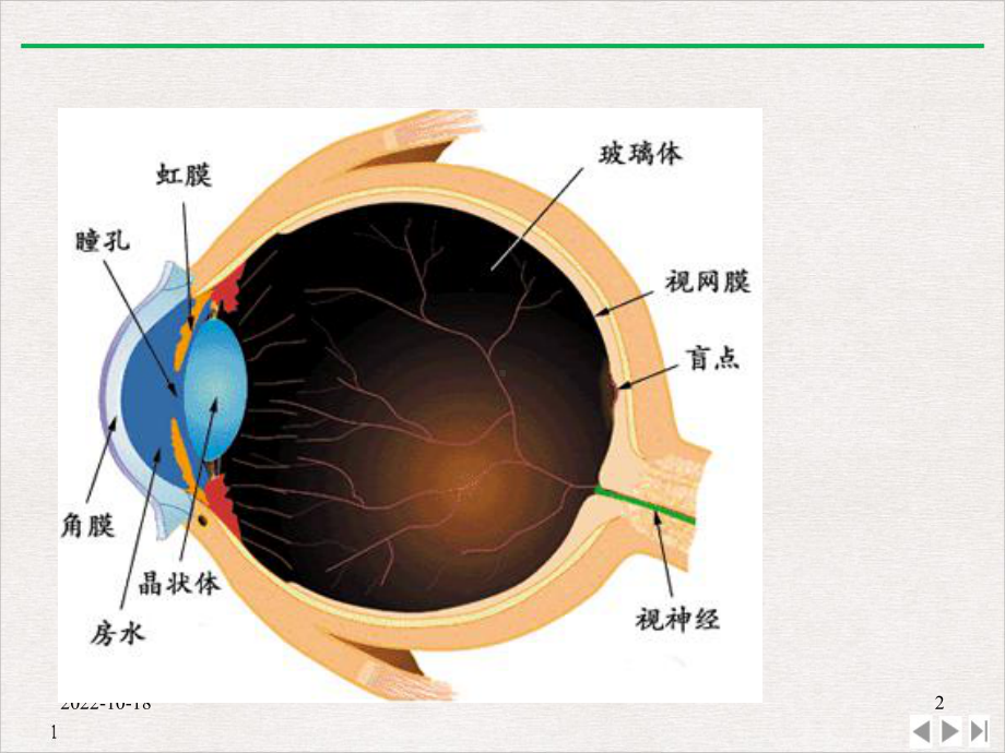 白内障围手术期护理课件.pptx_第2页