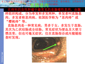 直肠息肉专题知识宣讲培训课件.ppt