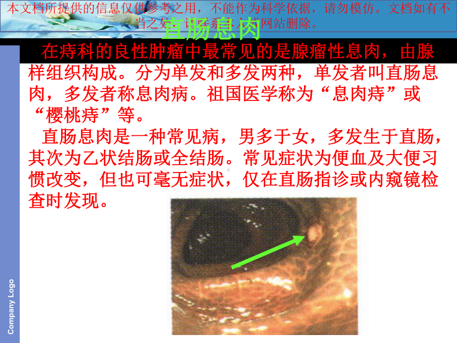 直肠息肉专题知识宣讲培训课件.ppt_第1页