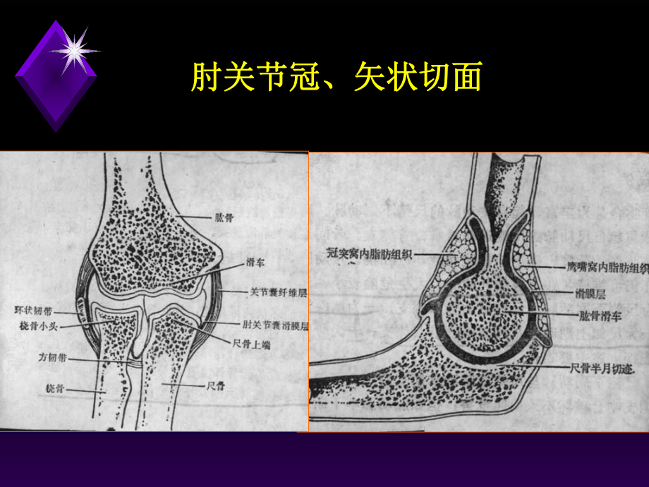 肘关节不稳定的诊治教学课件.ppt_第3页