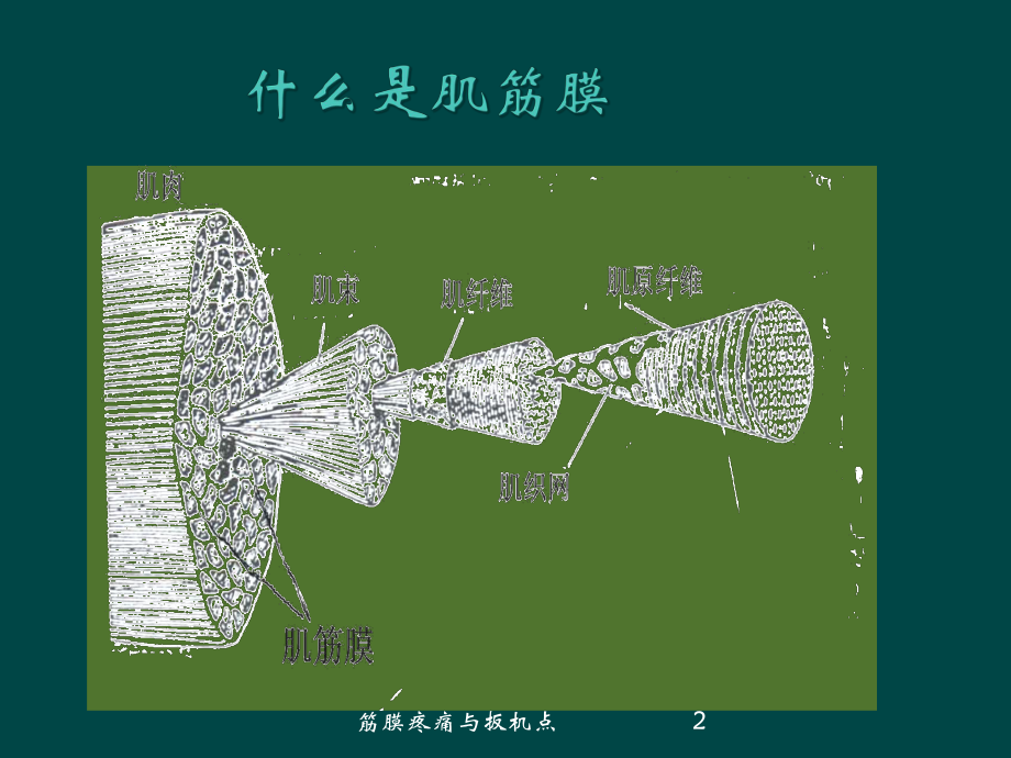 筋膜疼痛与扳机点培训课件.ppt_第2页