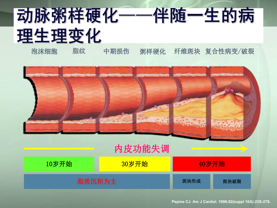 稳定性冠心病不等于斑块稳定学习课件.ppt_第2页