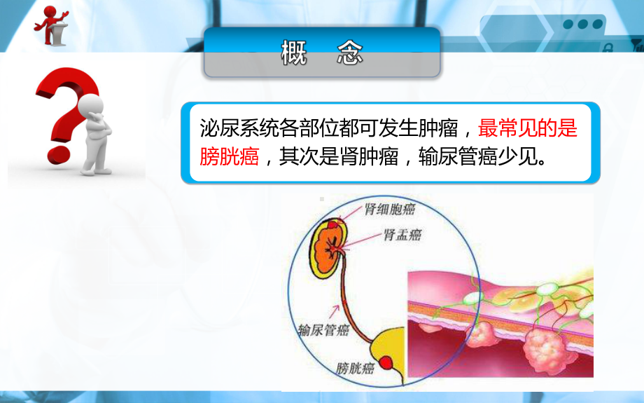 《外科护理》第十九章-第五节-泌尿系统肿瘤病人的护理课件.ppt_第2页