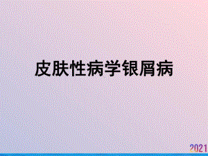 皮肤性病学银屑病课件.ppt