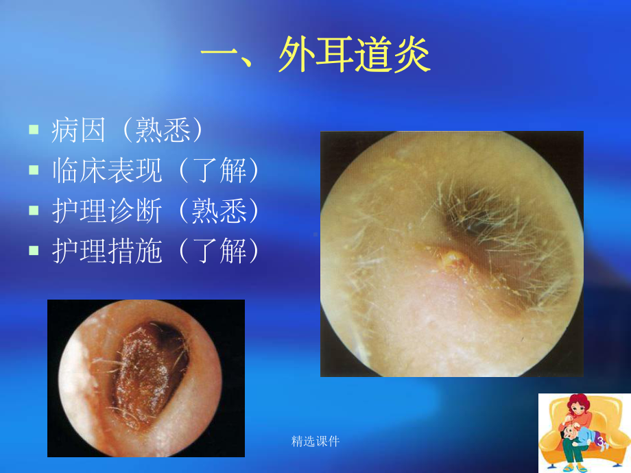 耳部常见疾病护理常规课件.ppt_第3页