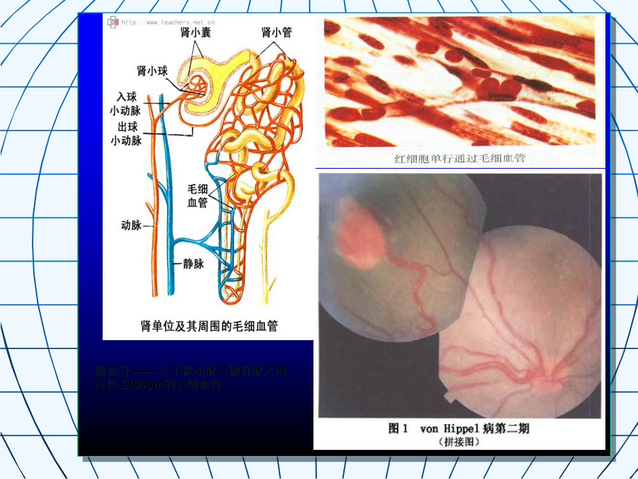 糖尿病微血管病(交流)课件.ppt_第3页