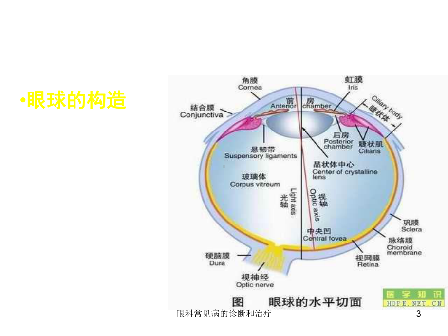 眼科常见病的诊断和治疗课件.ppt_第3页