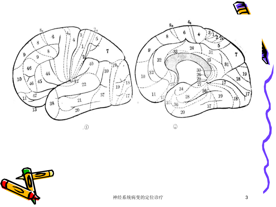 神经系统病变的定位诊疗培训课件.ppt_第3页