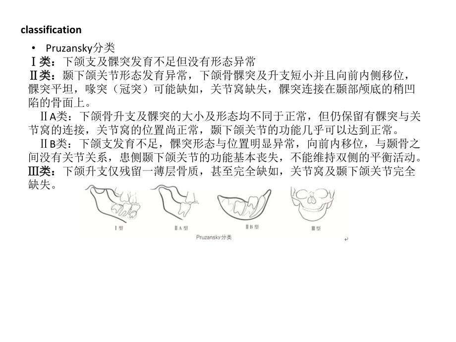 第一二鳃弓综合征正颌治疗进展-课件.ppt_第3页