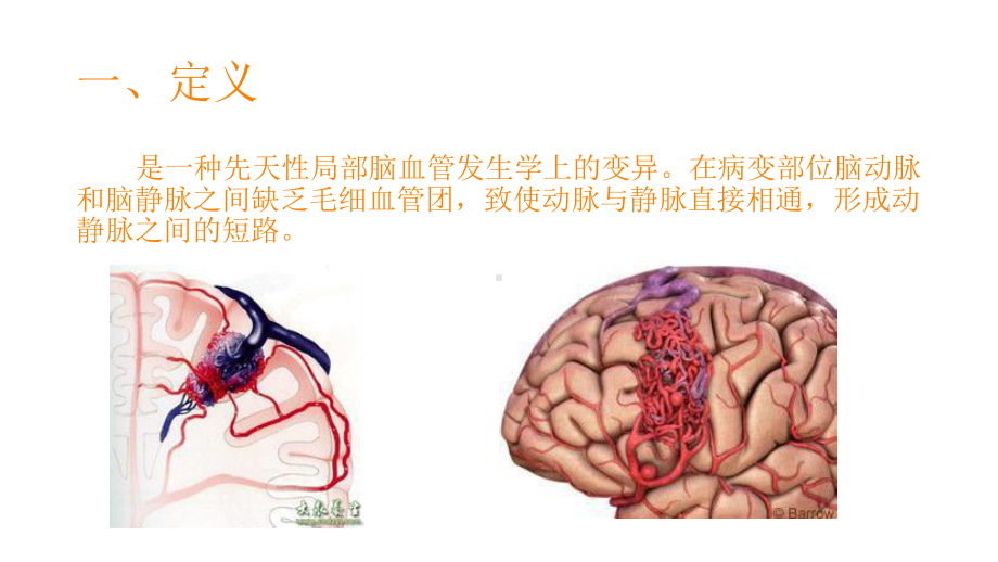 的诊断及治疗课件.pptx_第2页