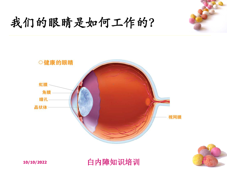 白内障知识培训培训课件.ppt_第1页