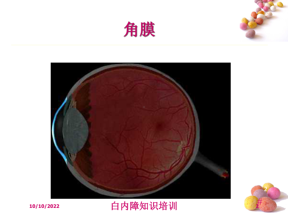 白内障知识培训培训课件.ppt_第2页