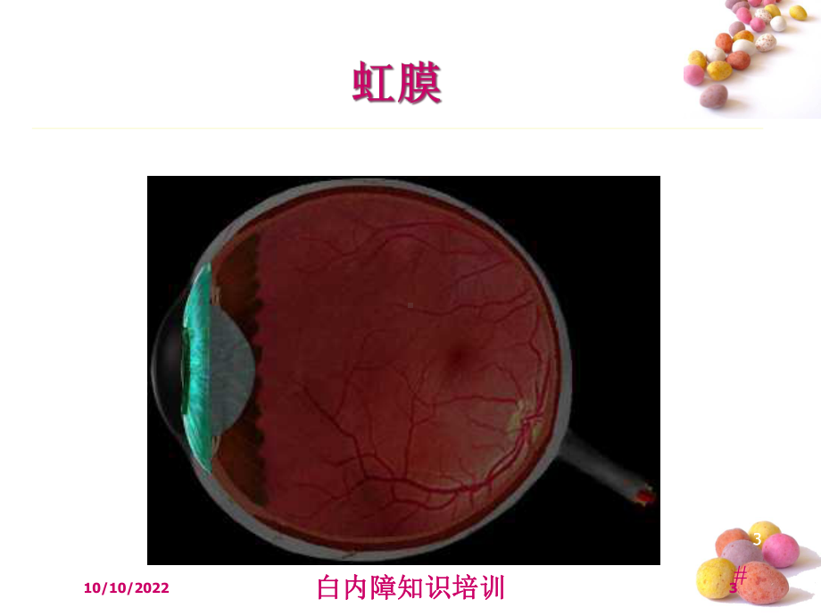 白内障知识培训培训课件.ppt_第3页