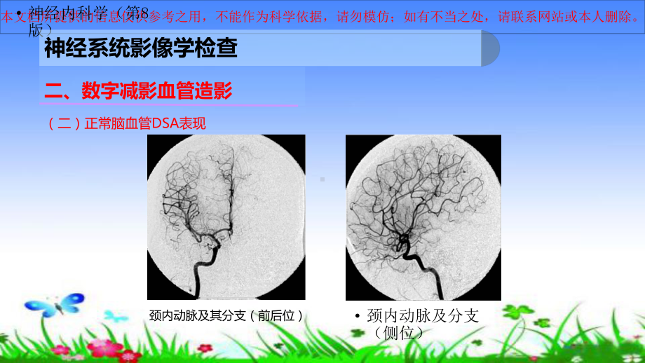 神经系统影像学检查培训课件.ppt_第3页