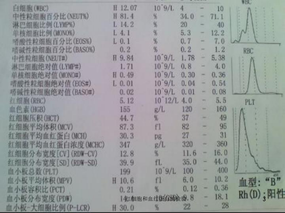 红细胞和血红蛋白的检验课件.ppt_第3页