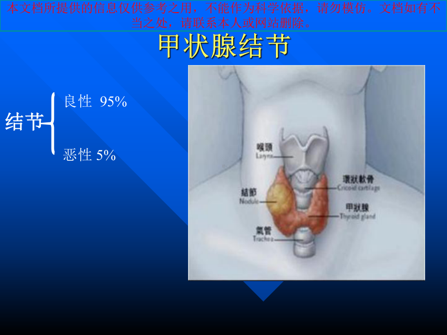 科普甲状腺结节培训课件.ppt_第2页