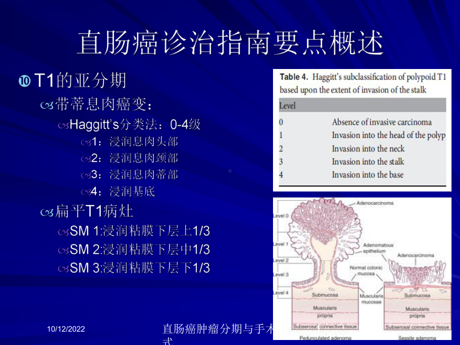 直肠癌肿瘤分期与手术方式培训课件.ppt_第1页