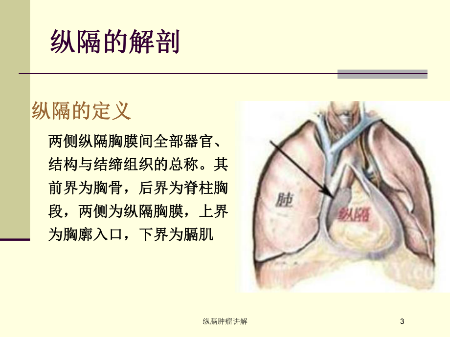 纵膈肿瘤讲解培训课件.ppt_第3页